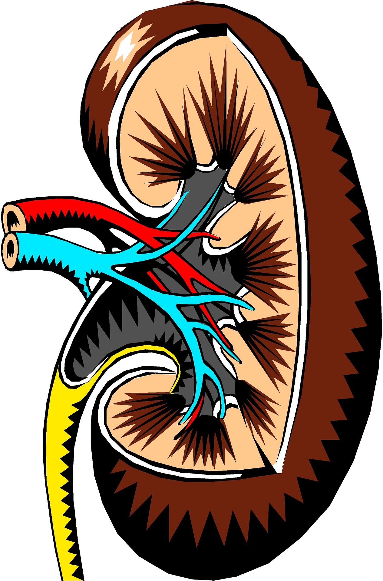 Kidney Stones : Unique way To Treatment 2025.