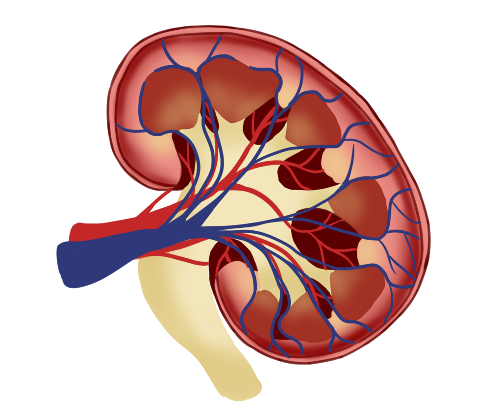 Kidney Failure