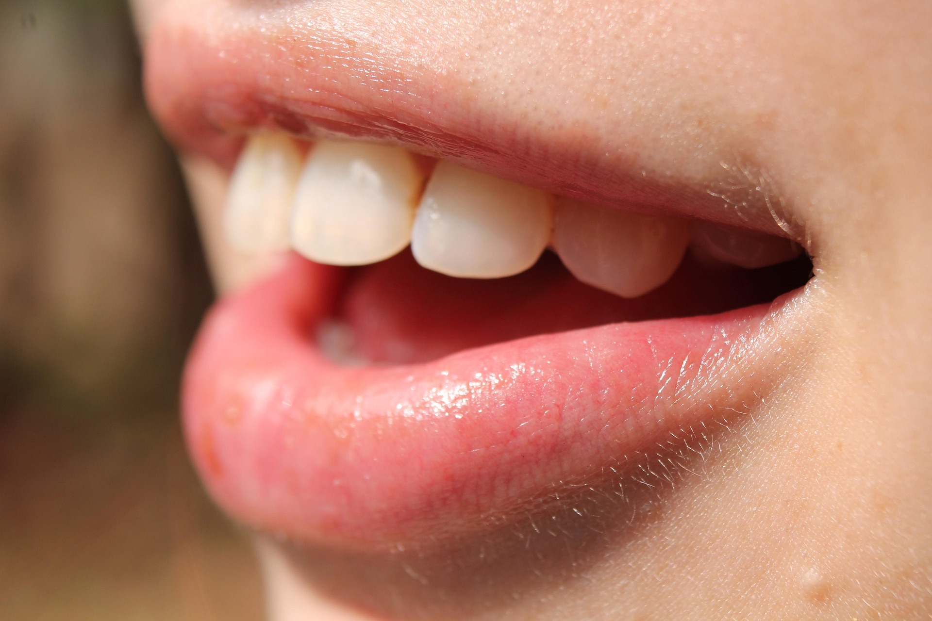Shiny tired and strong teeth: Simple care methods in summer!